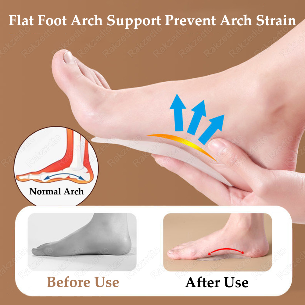 シリコーン靴パッド男性女性足底筋膜炎扁平足アーチサポート整形 - Women'S Shoes Plantar Fasciitis のレビューと価格